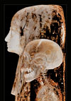 Mummified